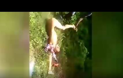 Gore video - The man had his arms and legs amputated while he was still alive - xgore