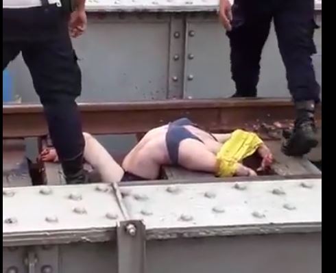 Gore video – The woman who had her arms and legs amputated by the train