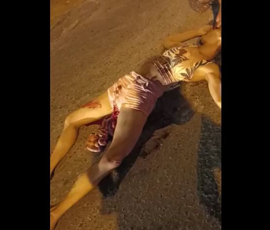 Gore video-  The woman’s internal organs popped out from her vagina after the accident