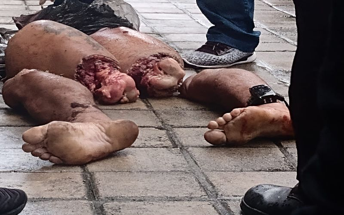 They collected the pieces of the man who had been dismembered and dumped on the street