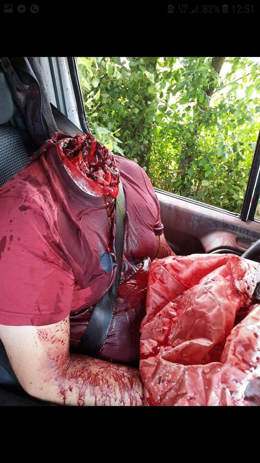 Creative suicide – He tied his head to a tree and sped up the car