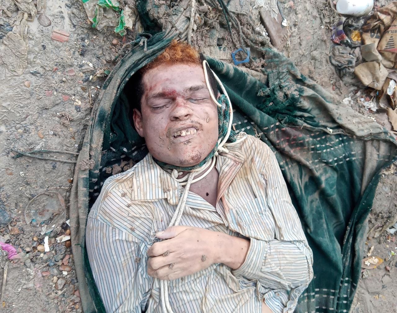 Brazilian man was strangled to death with a rope