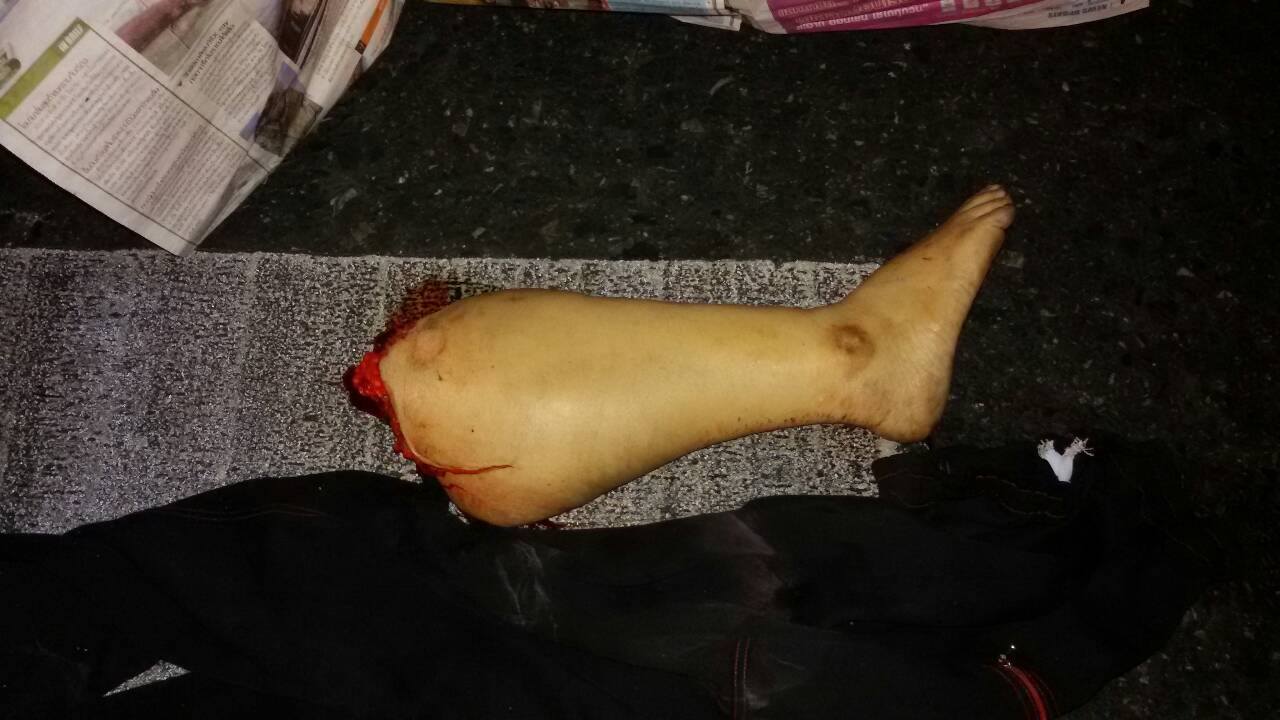 The woman was hit by a car and died, one of her legs was severed