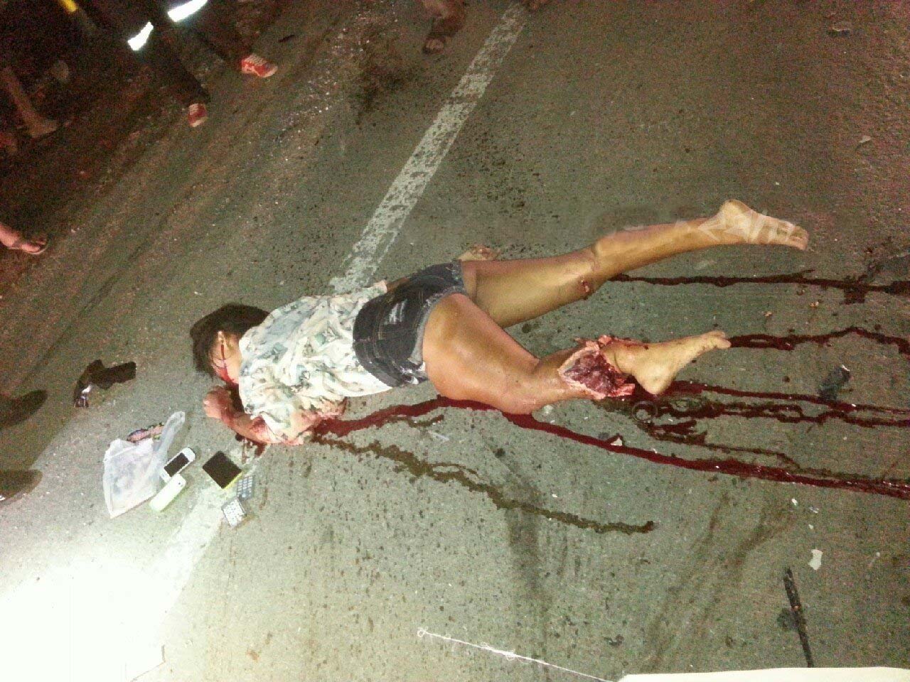 Thai traffic accident woman broke her leg