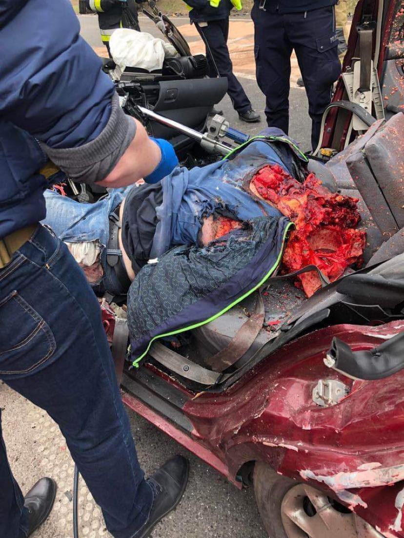 The driver’s head was shattered after colliding with an oncoming truck