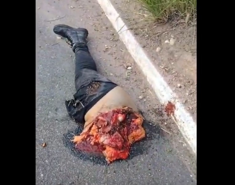 A woman’s leg was cut off in a traffic accident