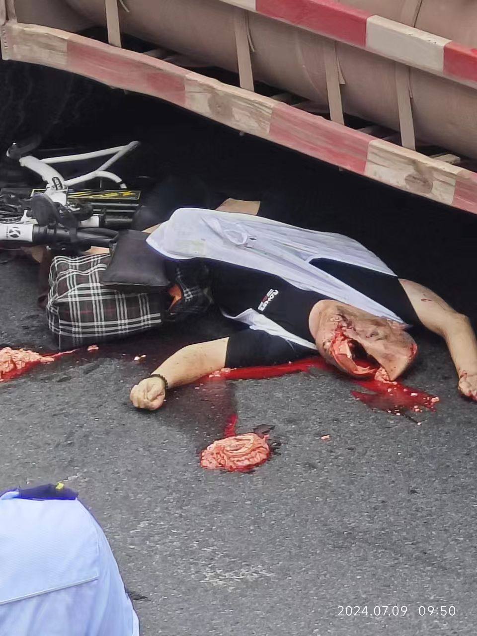 The man’s head was crushed by a truck and his brain was thrown out