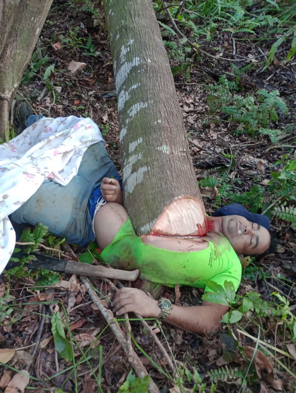 Man Dies in Horrific Accident After Tree Trunk Pierces Chest in Sirinhaém, Pernambuco, Brazil