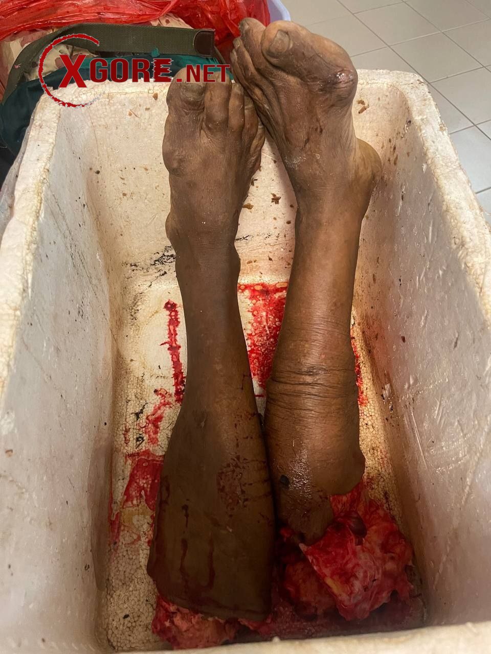 Cambodia Garbage Collector Killed: Legs Severed in Car Crash