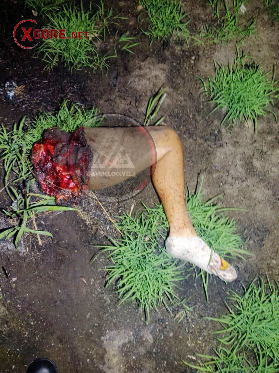 Motorcyclist Killed in Maturín Head-On Crash, Leg Severed in Boquerón Sector