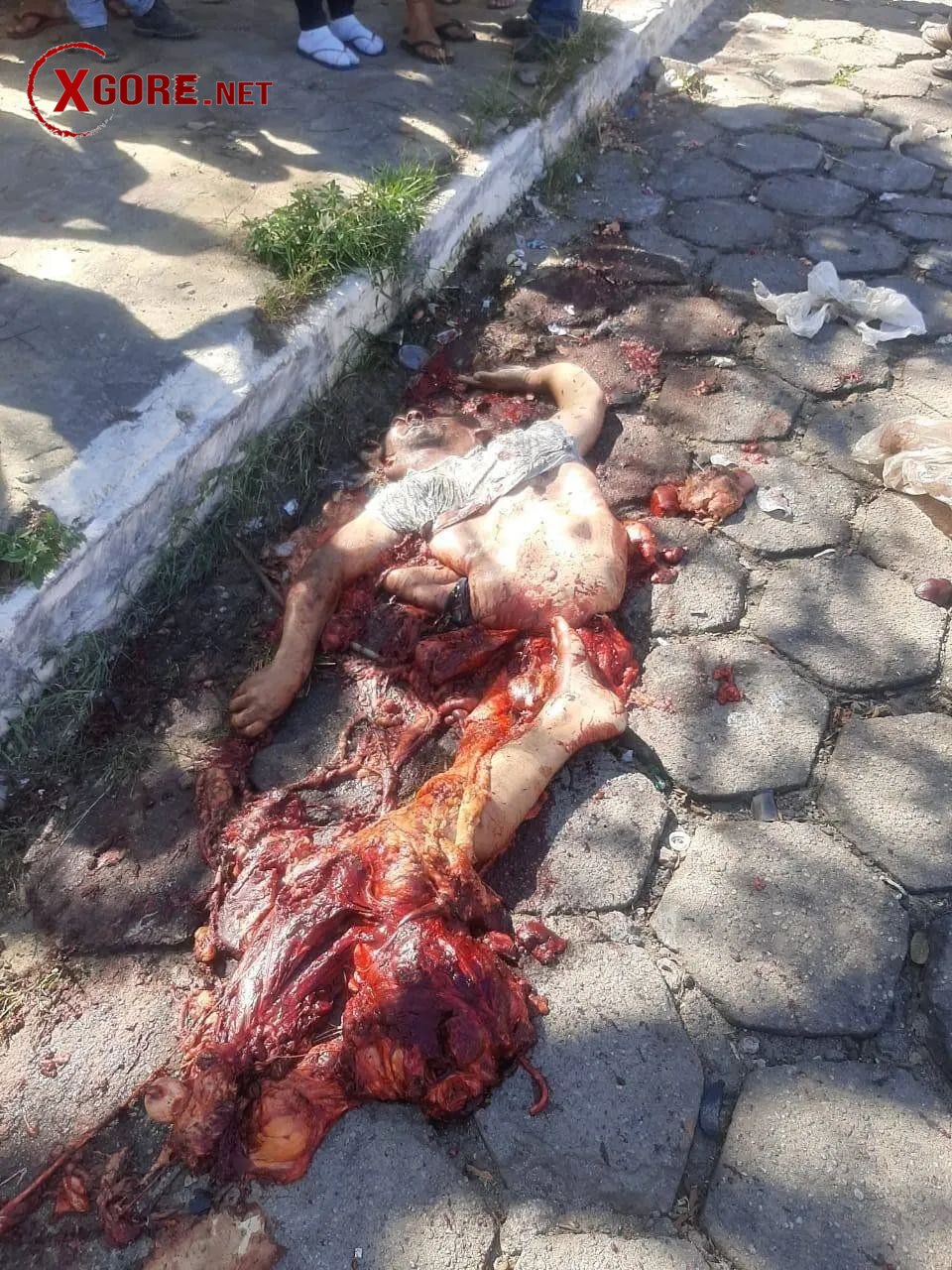 One case of being crushed by a truck has no information