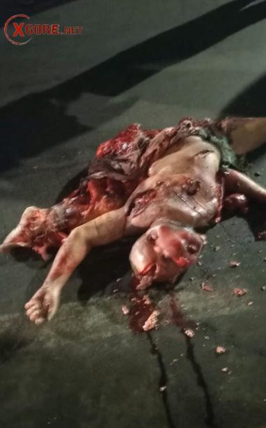 body scattered on the road