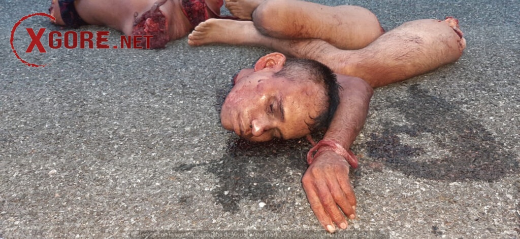 body parts on the street