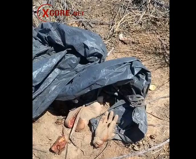 A severed foot and hand were seen