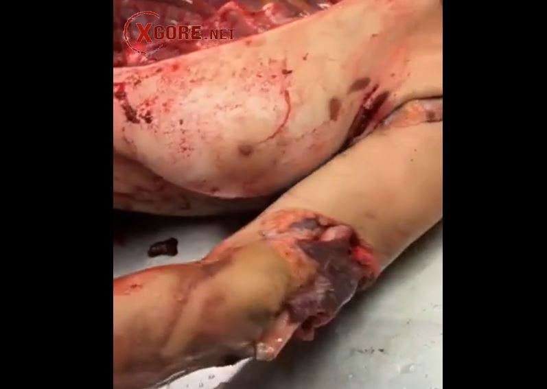 Autopsy of woman in motorcycle accident