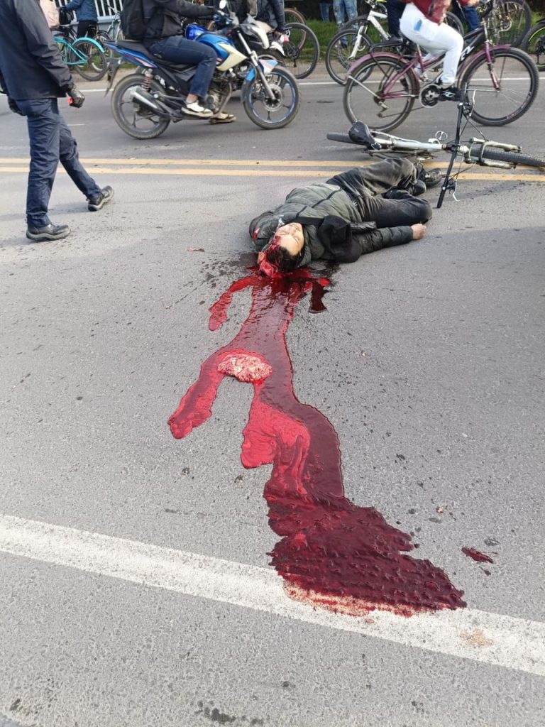 brain spilled out by accident