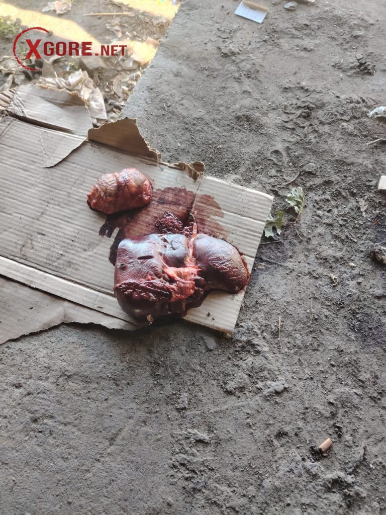 The homeless man had his stomach cut open-01