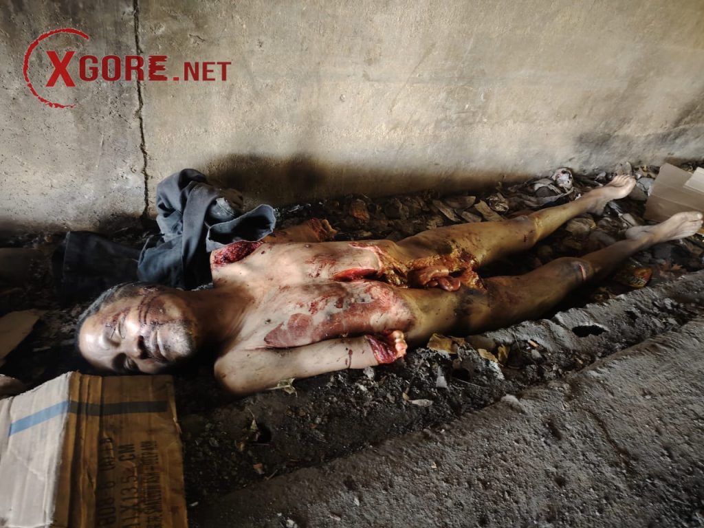 The homeless man had his stomach cut open-02