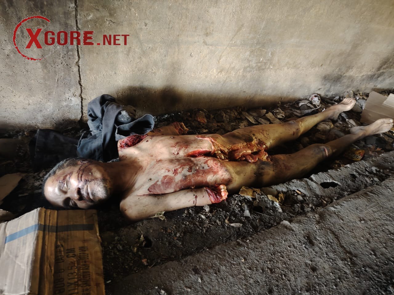 The homeless man had his stomach cut open and both his arms amputated