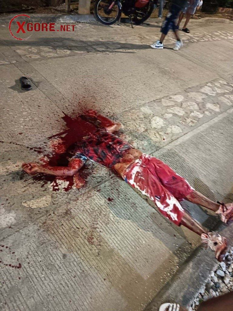 Man Decapitates Friend with Machete After Pool Game Argument in Coveñas, Colombia - 01