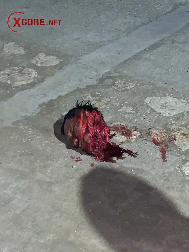 Man Decapitates Friend with Machete After Pool Game Argument in Coveñas, Colombia -02