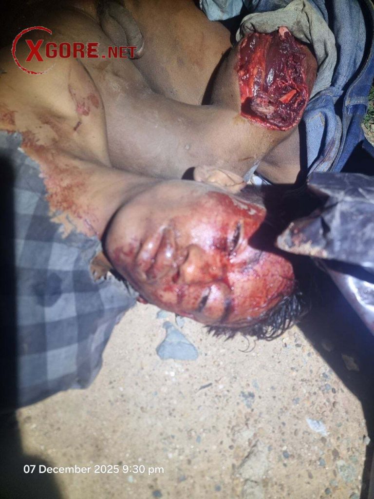 The young man was cut into pieces by the train-03