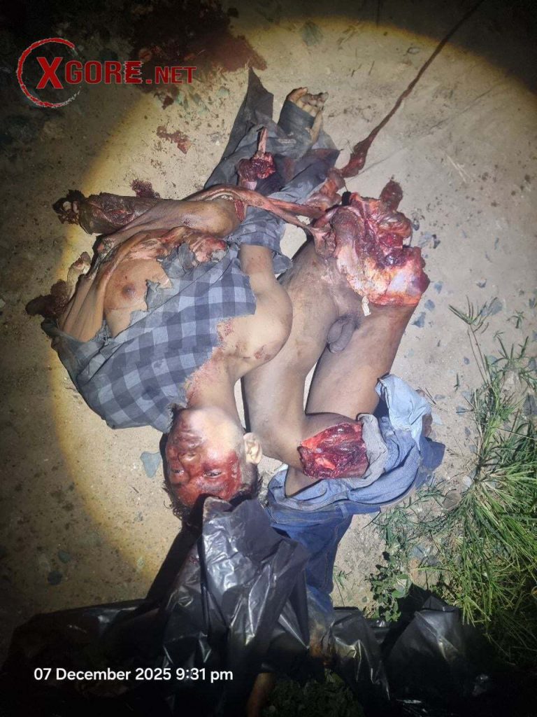 The young man was cut into pieces by the train-05