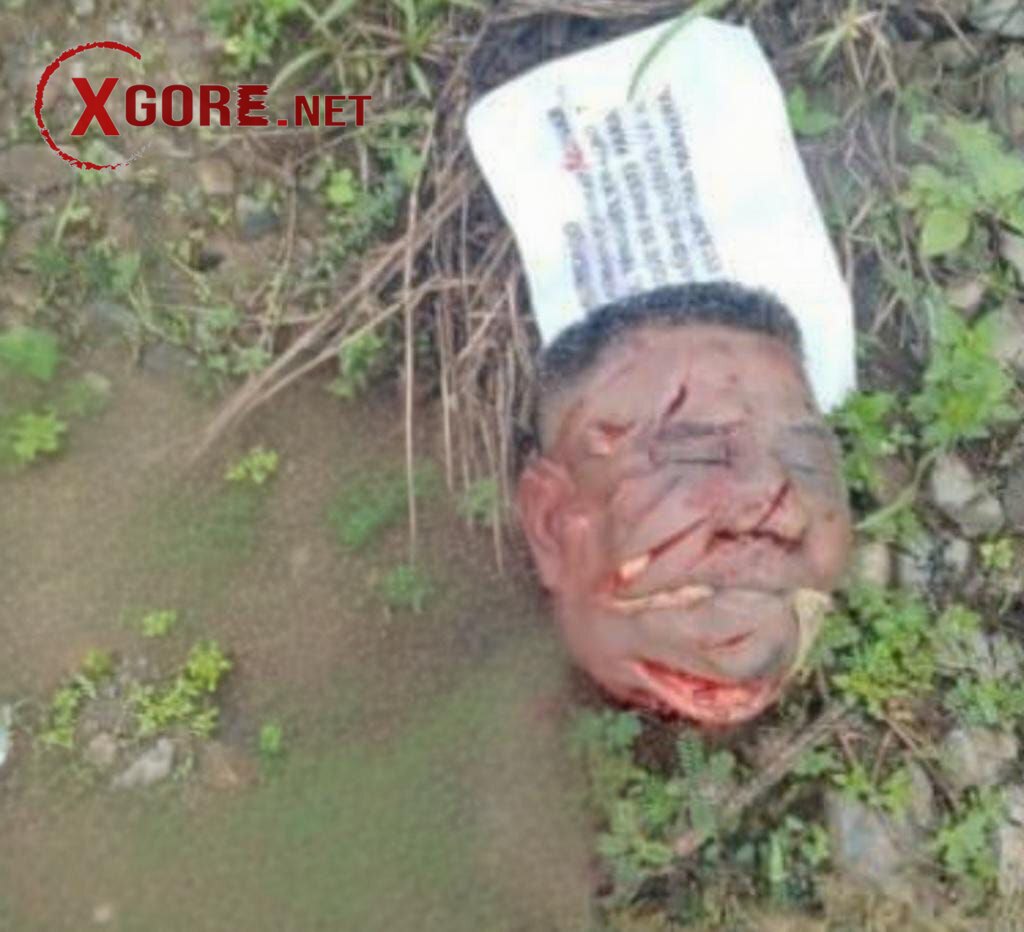 Two Severed Heads and Two Severed Arms