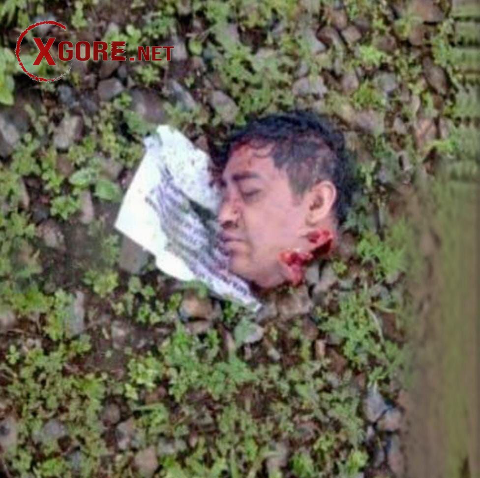 Two Severed Heads and Two Severed Arms 02