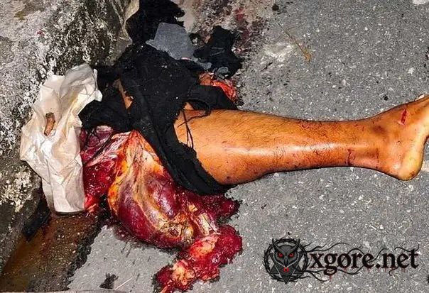 young man was torn apart 01