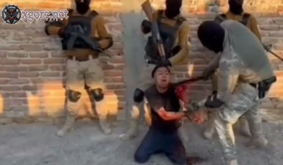 Man had his arm chopped off and was then shot in the head