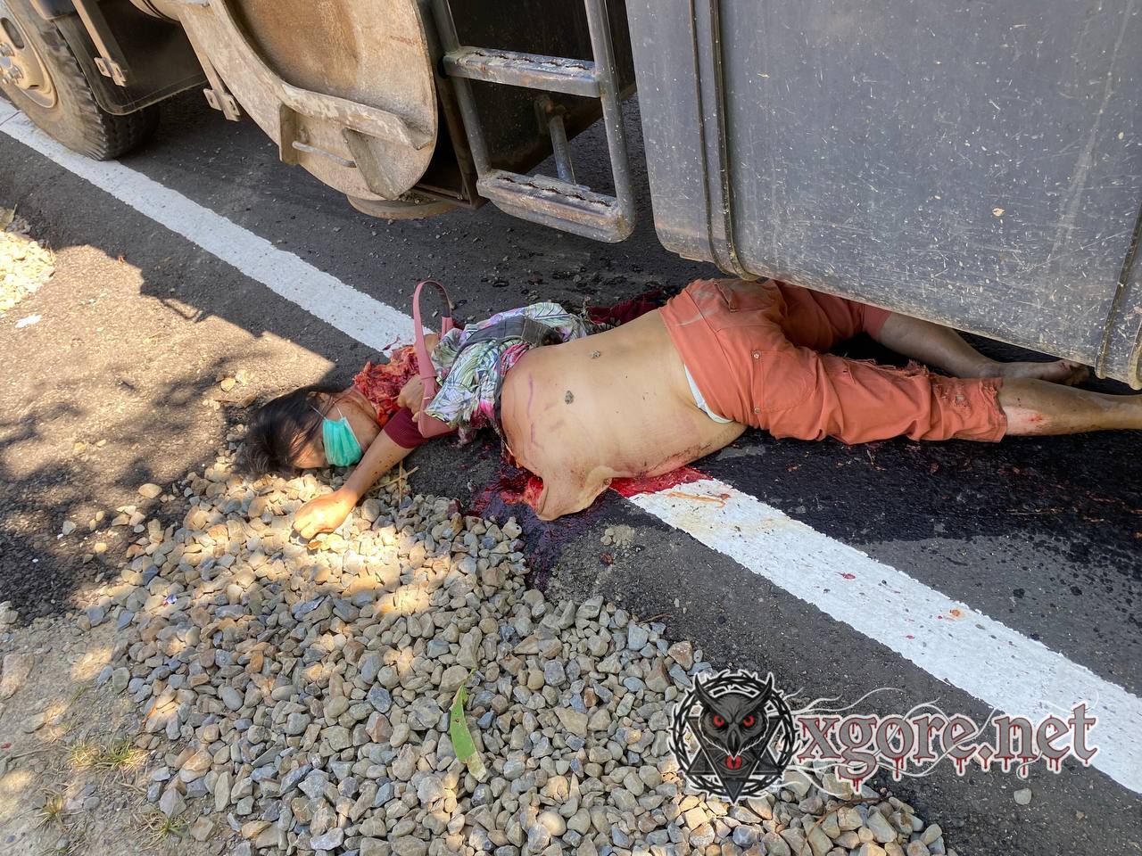 Tragic Motorcycle Accident in Gunungsitoli: Couple Crushed to Death by Crane Truck