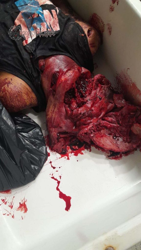 Man Arrested in Catanduva, Brazil for Brutal Pickaxe Murder with Crushed Skull 02