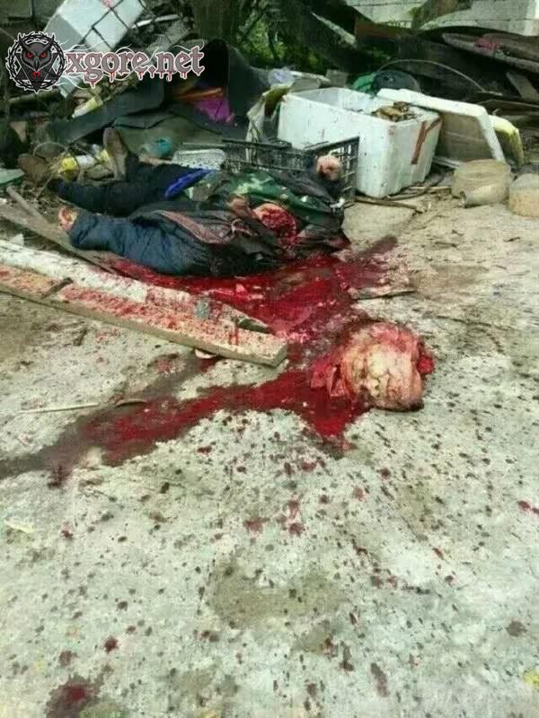 Guangxi Knife Attack: 23-Year-Old Man with Mental Illness Stabs Multiple Villagers in Pingnan County 02