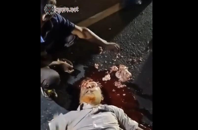 The man had a fractured skull and his brain had spilled out