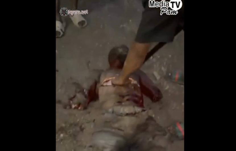The man was dismembered while still alive
